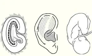 auricular therapy