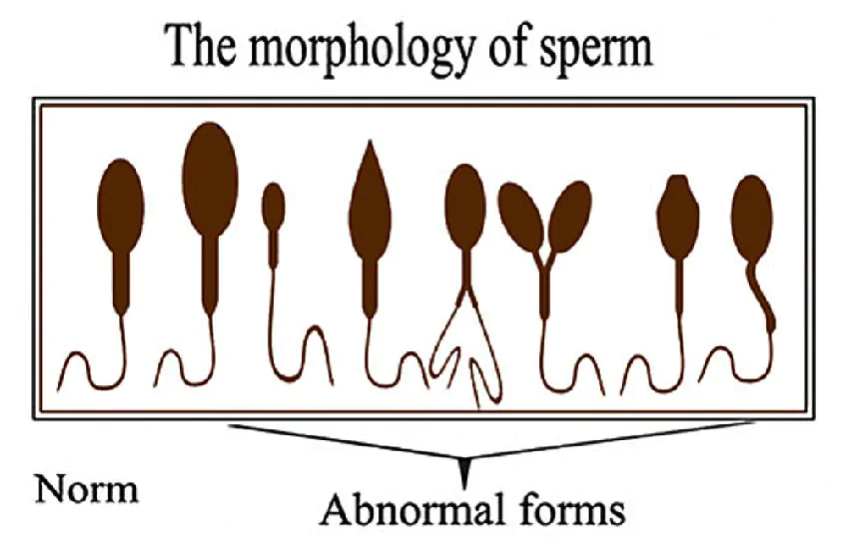 acupuncture for sperm morphology
